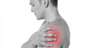 Shoulder pain syndrome