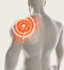 What is shoulder arthritis and what are its causes?